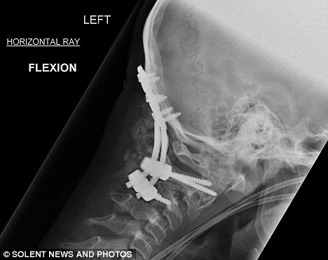 article-1203945-05EF21EB000005DC-922_468x371 article-1203945-05EF21EB000005DC-922_468x371